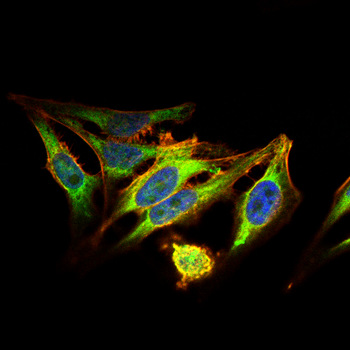 SST Antibody