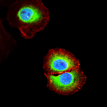 MMP1 Antibody