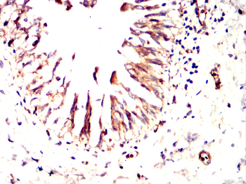 MMP1 Antibody