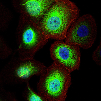 FOXO1 Antibody
