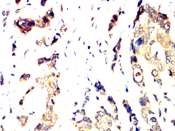 FOXO1 Antibody