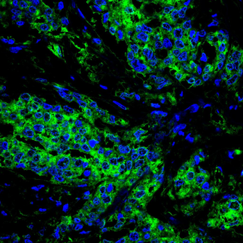 FOXO1 Antibody