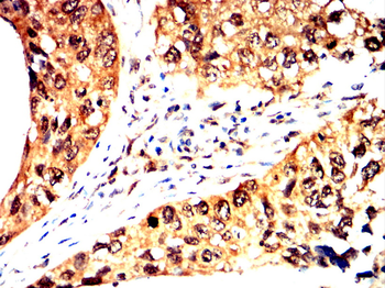 FOXO1 Antibody