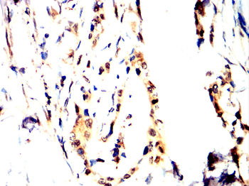 FOXO1 Antibody