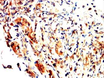 FOXO1 Antibody
