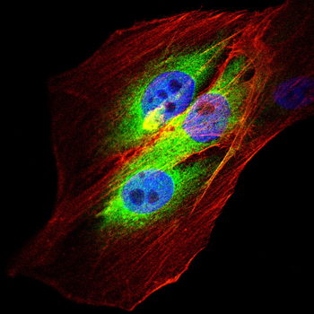 NPHS2 Antibody