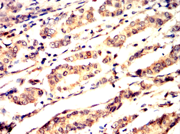 CDK4 Antibody