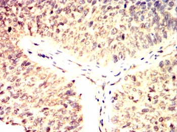 CDK4 Antibody