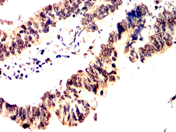 CDK4 Antibody
