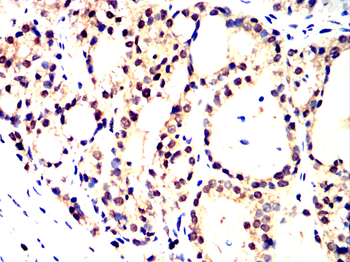 CDK4 Antibody
