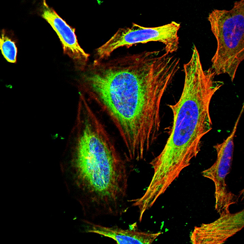 EFNB2 Antibody