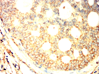 ITGAV Antibody