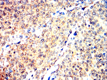 ARNT Antibody