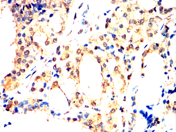ARNT Antibody
