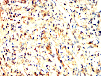 LDHB Antibody