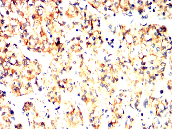 HAPLN1 Antibody