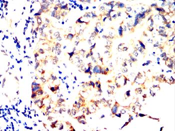 HAPLN1 Antibody