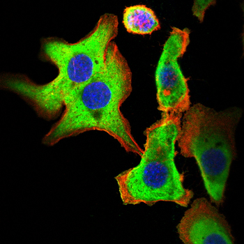 YBX1 Antibody