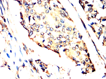 YBX1 Antibody