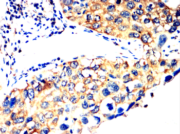 YBX1 Antibody