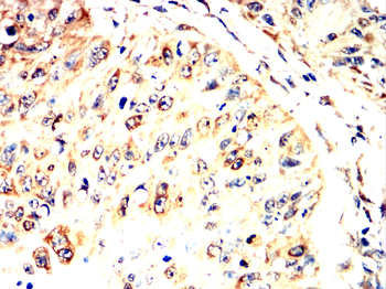 YBX1 Antibody