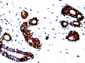 HSPH1 Antibody