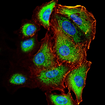 FTL Antibody
