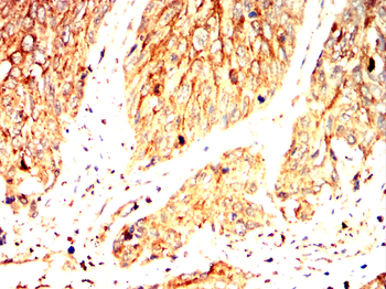 FTL Antibody