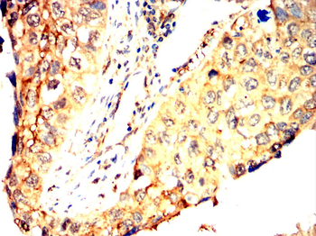 FTL Antibody