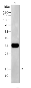 FTL Antibody