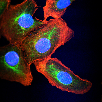 ULK1 Antibody