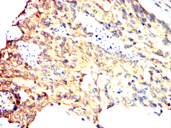 ULK1 Antibody