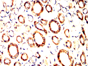ULK1 Antibody