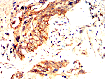 ULK1 Antibody