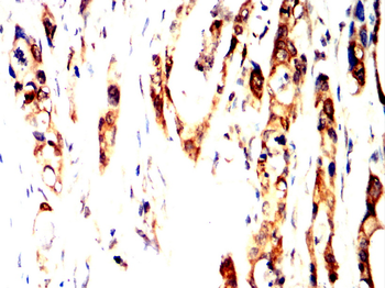 ULK1 Antibody