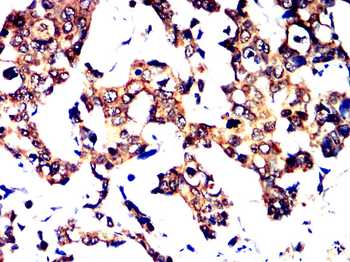 NR1H3 Antibody