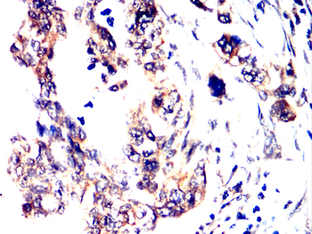 NR1H3 Antibody