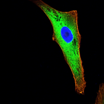 ATP2A2 Antibody