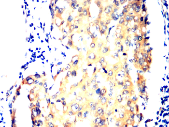 ATP2A2 Antibody