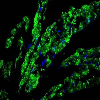 ATP2A2 Antibody