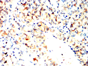 ATP2A2 Antibody