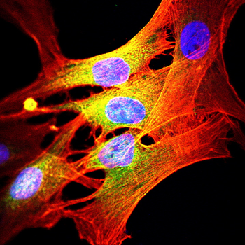 TOP2A Antibody