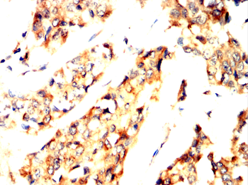 TOP2A Antibody