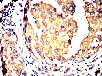 TOP2A Antibody
