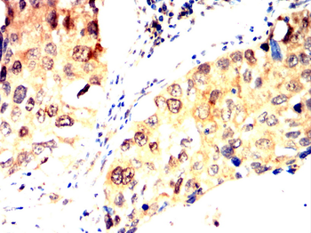 TOP2A Antibody