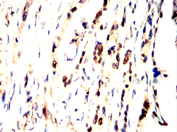 TOP2A Antibody
