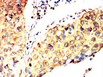 KIF23 Antibody