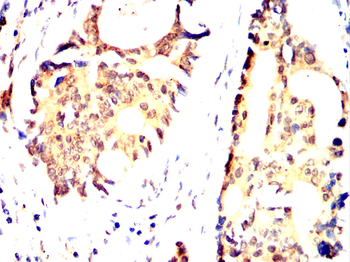 ABCG2 Antibody