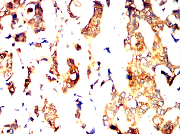 PFKM Antibody