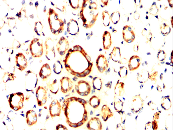 PFKM Antibody